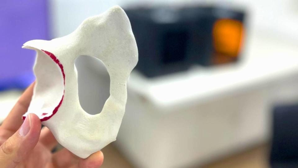 Trimaker, de impresión 3D, ahora se lanza al rubro de la medicina para facilitar la impresión de prótesis