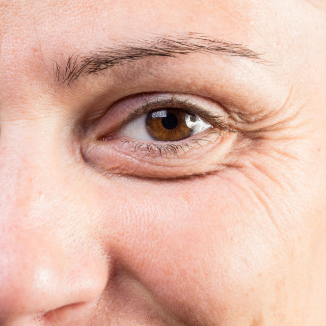 5 Products Every Women Over 40 Should Be Using For Under-Eye Bags - SHEfinds