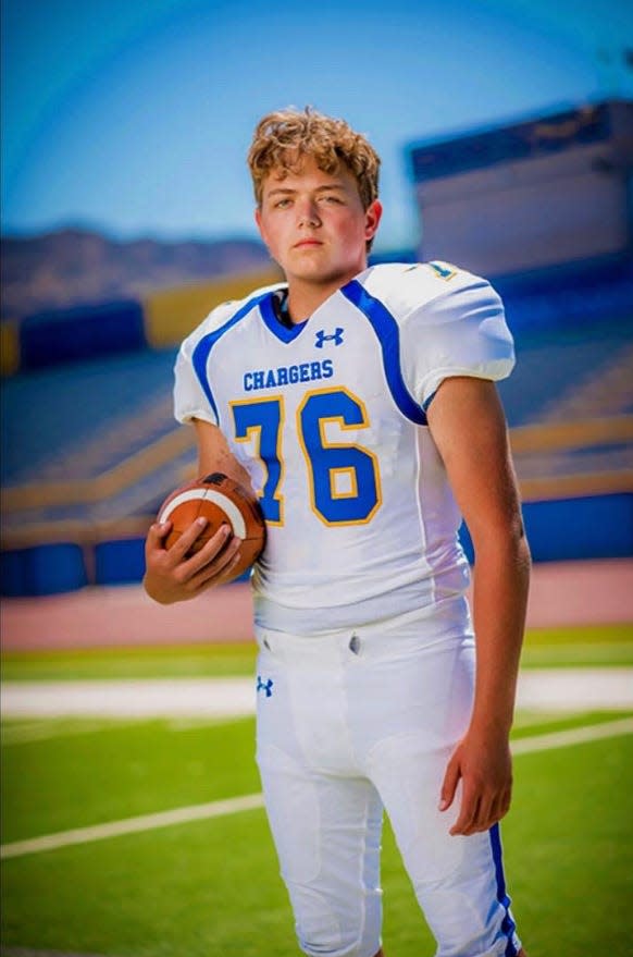 Agoura High freshman Carter Stone died Thursday after suffering complications from shoulder surgery. He was later found to be suffering from undiagnosed leukemia.