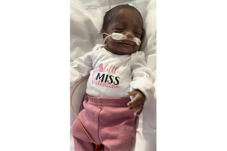 This undated photo shows 6-month-old Nyla Brooke Haywood, a baby girl born Nov. 17, 2023, at Silver Cross Hospital in New Lenox, Illinois. Nyla was born at just 22 weeks weighing 1 pound and 1 ounce, making her what’s known as a “micropreemie.” She left Silver Cross Hospital on Monday weighing a healthy 10 pounds, and was taken home by her first-time parents, NaKeya and Cory Haywood of Joliet, Illinois. (NaKeya Haywood via AP)