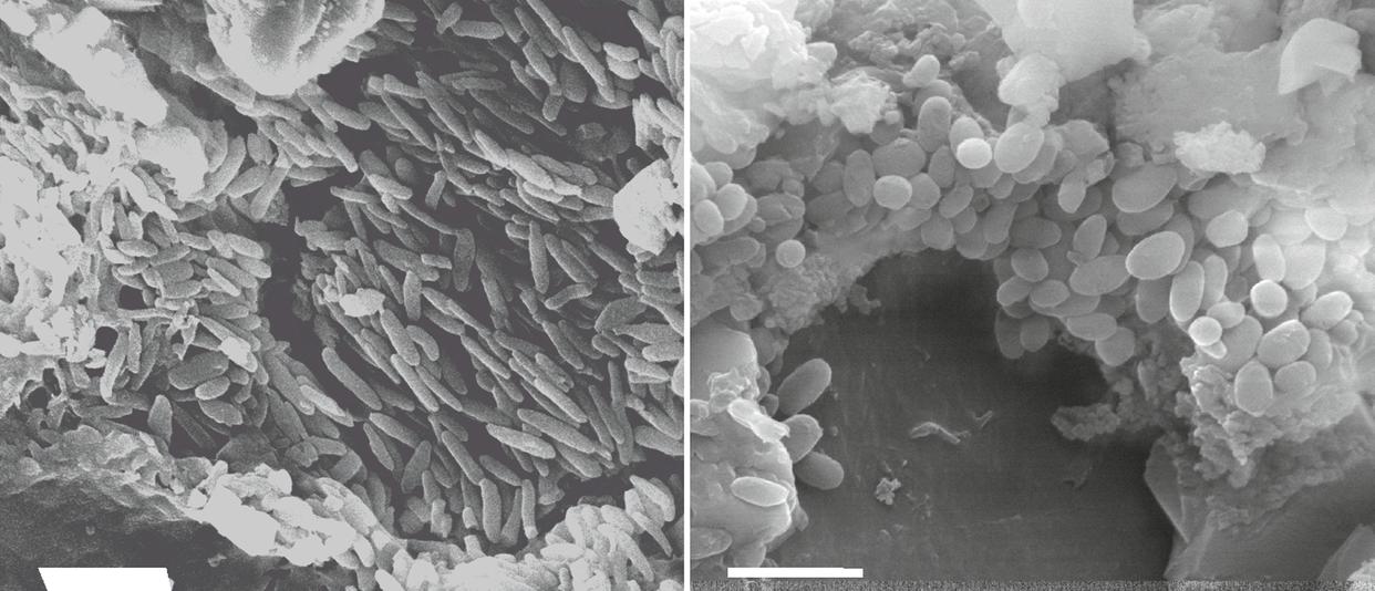 A micrograph of preserved melanosomes in the two feather types associated with the Brazilian pterosaur. On the left are the elongated melanosomes found in the monofilaments, and on the right are the stubby, short melanosomes found in the branched feathers. (Maria McNamara)