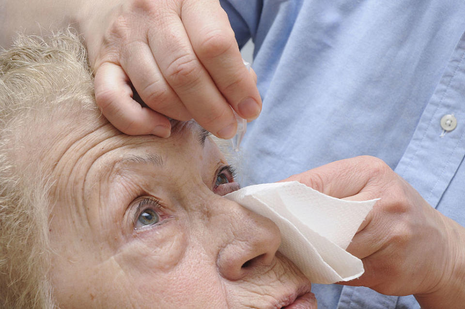 Dry eye can cause real problems. Source: Getty