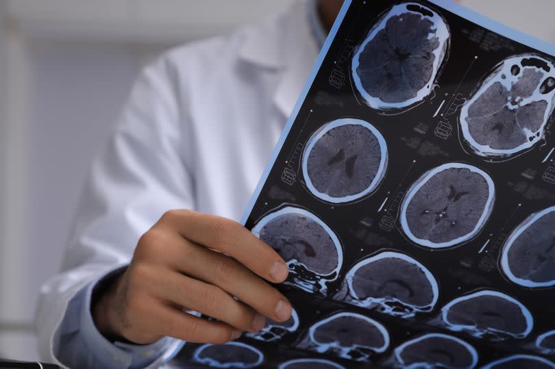 Doctor examining MRI images of patient with multiple sclerosis in clinic, closeup