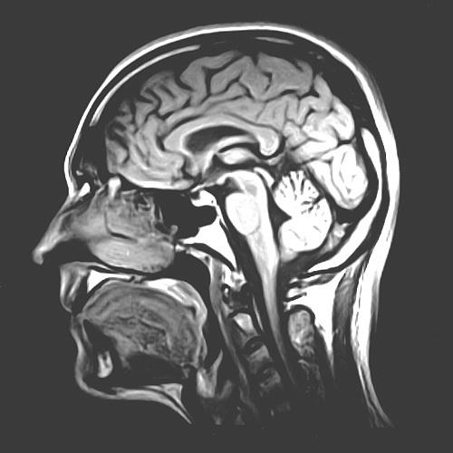 An MRI scan reveals the gross anatomical structure of the human brain.