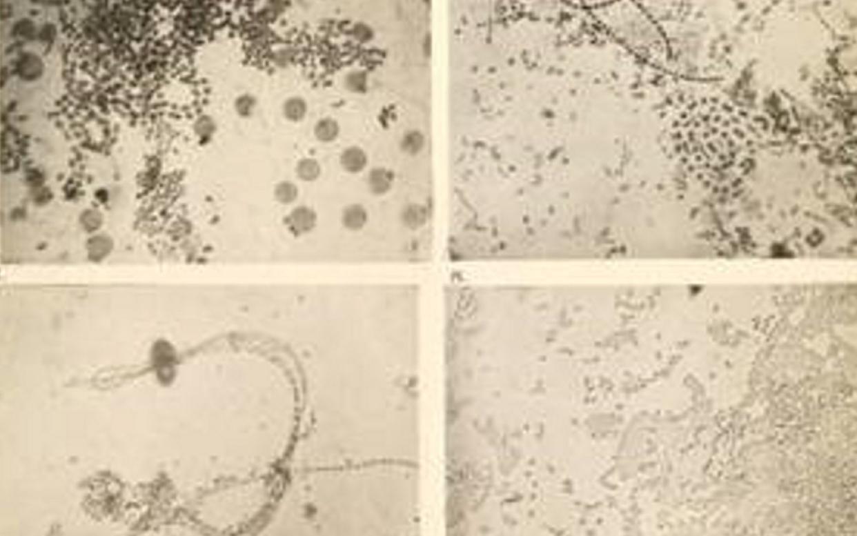 A German periodical containing the first known photograph of bacteria is among the items in the library