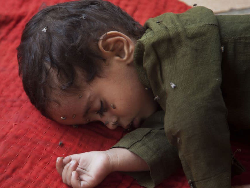 A child waiting for medical aid for suspected heatstroke at a children's hospital in Karachi: AP