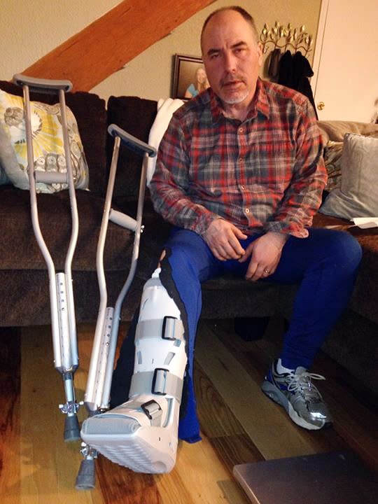 In this image provided by Chelsea Janssen, musher Scott Janssen poses for a photo showing his broken ankle on Wednesday, March 5, 2014 in Anchorage, Alaska. Janssen was flown to a hospital after a harrowing ordeal that included crashing his sled, hitting his head on a stump and later falling through ice and breaking his ankle during the Iditarod Trail Sled Dog Race. Janssen, an Anchorage undertaker known as the Mushing Mortician, was back home early Wednesday after getting a cast for the broken bone he suffered on Tin Creek, about 40 miles from Nikolai, Alaska. (AP Photo/Chelsea Janssen)