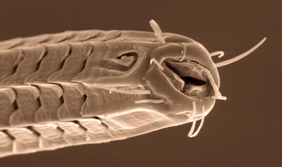 Microscopic image of the Ceramonema nematode.