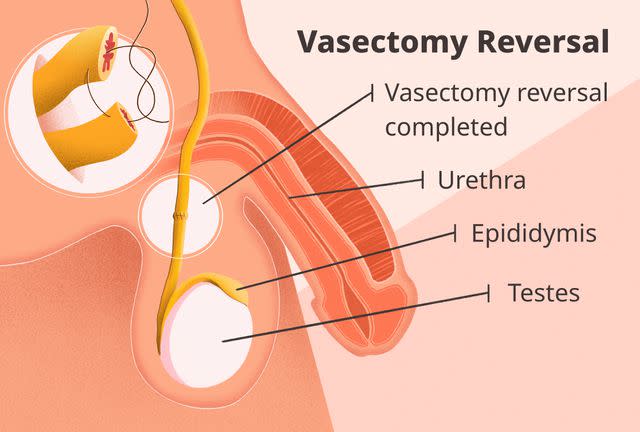 <p>Illustration by Julie Bang for Verywell Health</p>