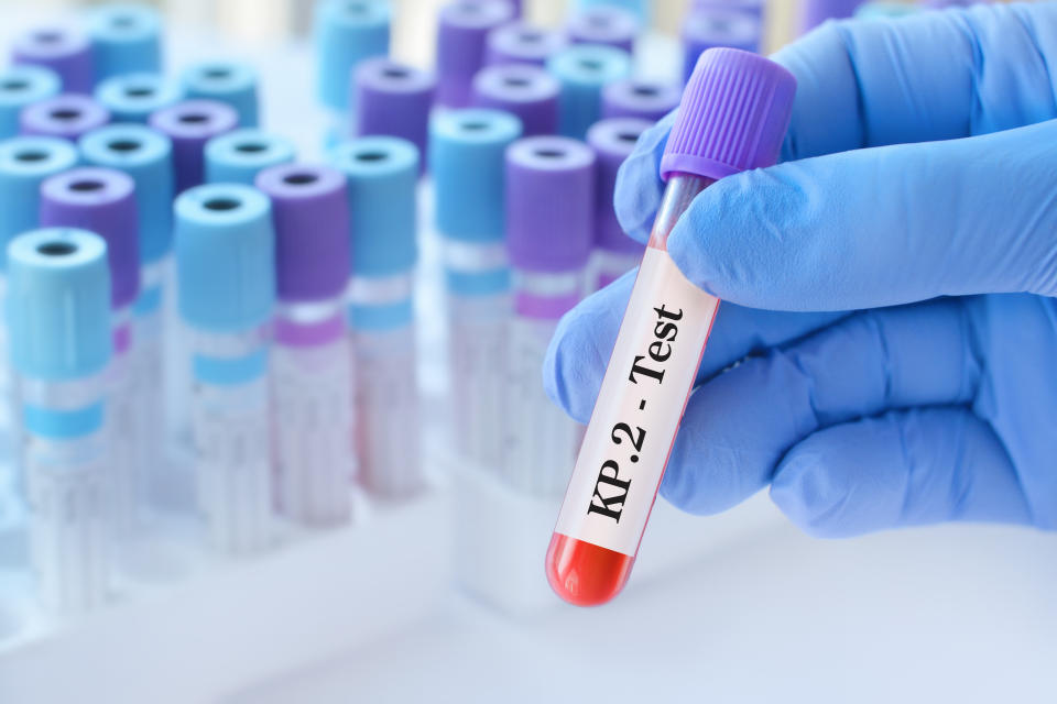 Doctor holding a test blood sample tube for the detection of the virus KP.2 on the background of medical test tubes. KP.2, one of the FliRT variants. Symptoms with FLiRT are the same as with omicron