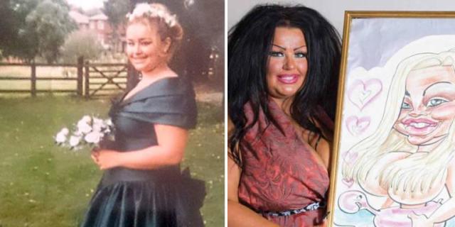 From trout pout and bazooka breasts to faux natural - how plastic surgery  has advanced in ten years