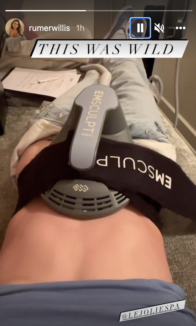 Rumer Willis posts a video of herself receiving an EmSculpt Neo treatment. (Photo: Rumer Willis/Instagram)