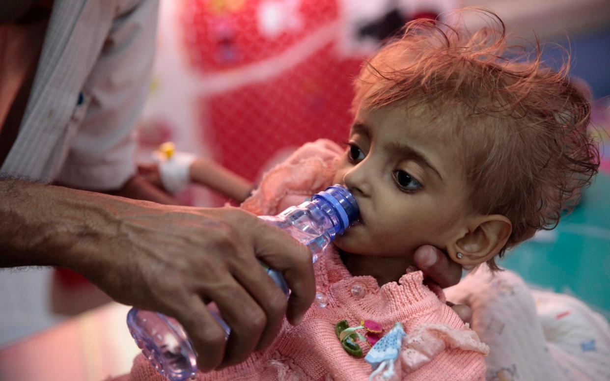 A father gives water to his malnourished daughter at a feeding center in a hospital in Hodeida, Yemen - AP