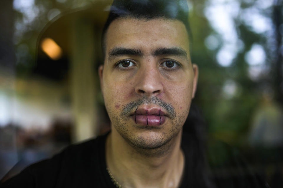 A man from Morocco, no name given, with his lips sewn together and on hunger strike poses for a photo as he occupies with others a big room of the ULB Francophone university in Brussels, Tuesday, June 29, 2021. More than two hundreds of migrants without official papers and who have been occupying a church and two buildings of two Brussels universities since last February, began a hunger strike on 23 May to draw the attention of Brussels authorities to their plight. (AP Photo/Francisco Seco)