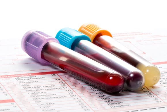 Blood vials on a diagnostic test request form.