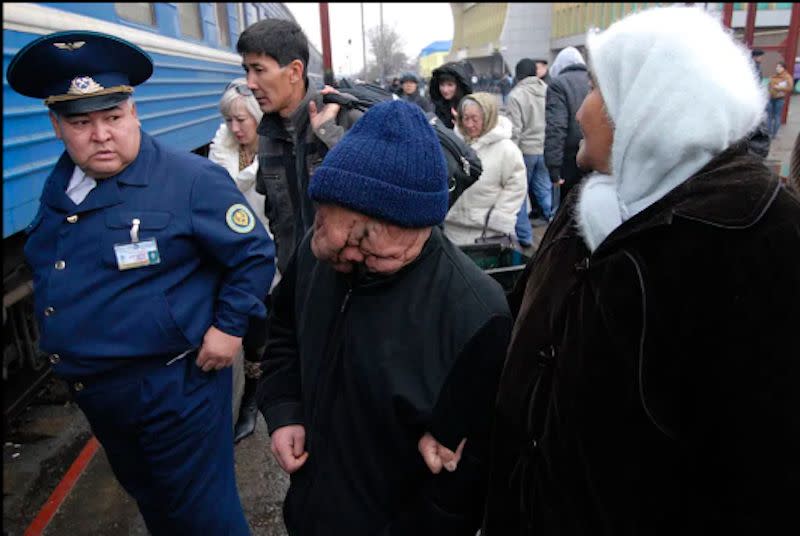 ▲受到核試爆輻射塵、風的影響，塞米伊（Semipalatinsk）地區的居民大多都有不同程度的畸形、癌症。（圖／翻攝自網路）