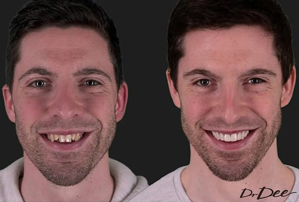 Patrick Dwyer’s teeth transformation.