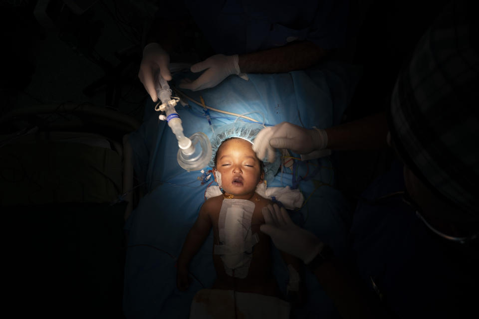 Yazan, 1, has his oxygen mask removed after his heart surgery at the Tajoura National Heart Center in Tripoli, Libya, on Feb. 27, 2020. Yazan’s perilous trek from his small desert hometown culminated in a five-hour surgery. He is one of 1,000 children treated by Dr. William Novick’s group since it first came to Libya after the 2011 uprising. (AP Photo/Felipe Dana)