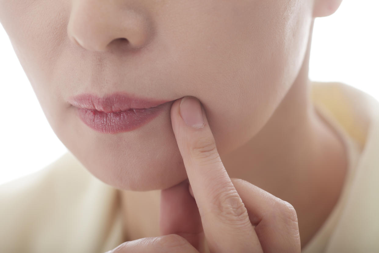 Le cancer de la bouche peut rester longtemps sans symptôme