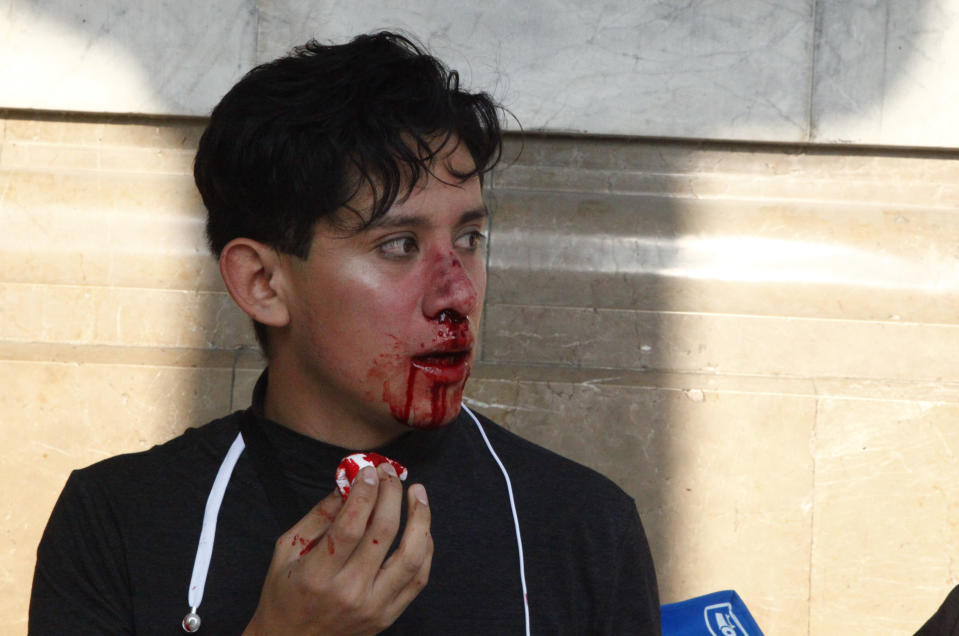 Miembro de la comunidad LGTB en México agredido por detractores del cuadro sobre Zapata. (Getty Images)