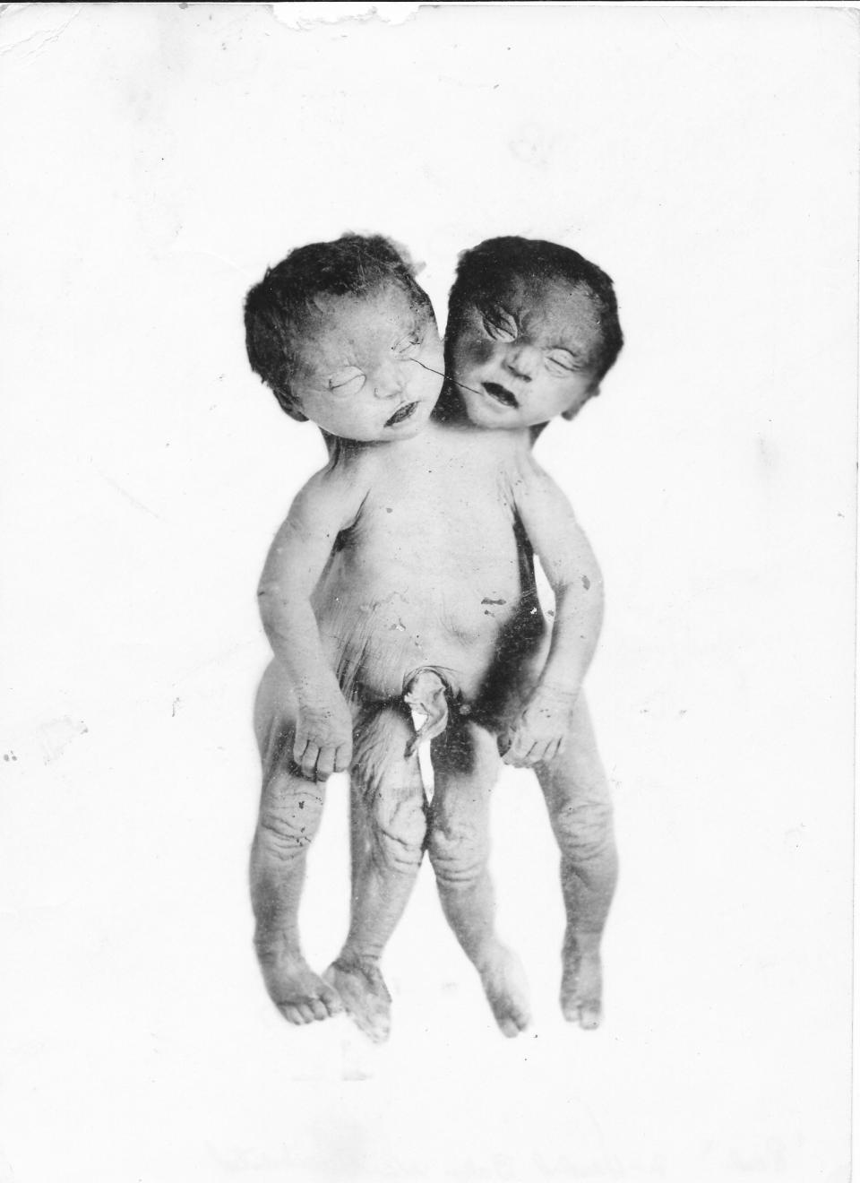 Now Hall's life is going to be the subject of a new book that will tell about his life, including his experiences as a sideshow barker selling people on sights such as this two-headed baby.