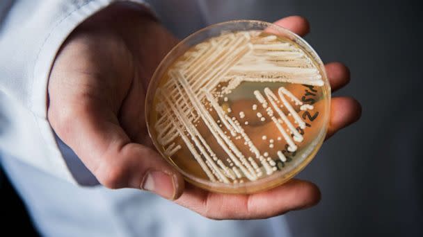 PHOTO: The director of the National Reference Centre for Invasive Fungus Infections, Oliver Kurzai, holds a petri dish containing the yeast candida auris, Jan. 23, 2018, in Wuerzburg, Germany. (Nicolas Armer/Picture Alliance via Getty Images,FILE)