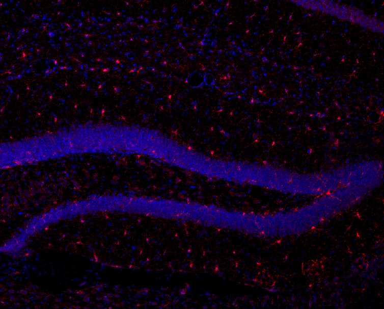 <span class="caption">Image showing microglia in the mouse brain. Microglia were stained red.</span> <span class="attribution"><span class="source">Chao Wang</span></span>