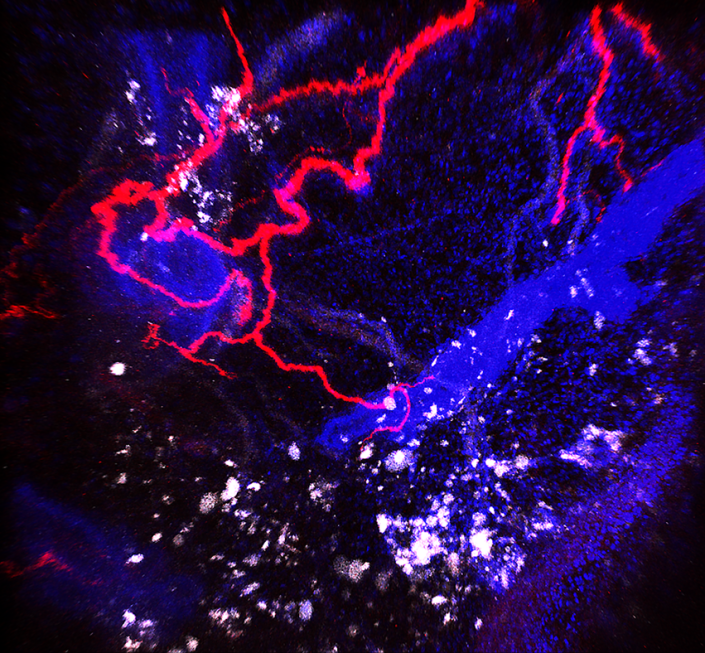 Nerves (in red) embedded in the breast tumor (white) of a mouse.