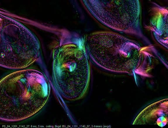 Here, live Vorticella visualized using a high-speed microscope developed at MIT.