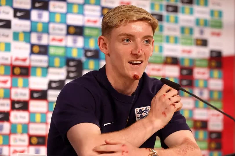 Anthony Gordon speaks to the media during an England press conference.