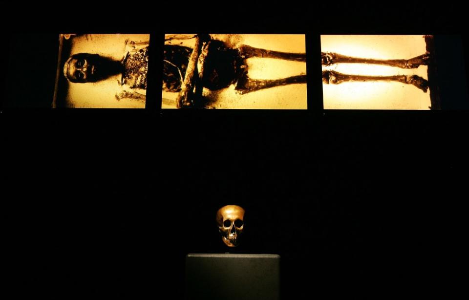 Medical imagery of Tutankhamun is shown above a replica of King Tut’s skull on display during the “Tutankhamun And The Golden Age Of The Pharaohs” at the Los Angeles County Museum of Art in California. Getty Images