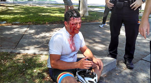 A cyclist who claims he was not involved with the white nationalist group was also left with injuries. Photo: Dave Id/Twitter