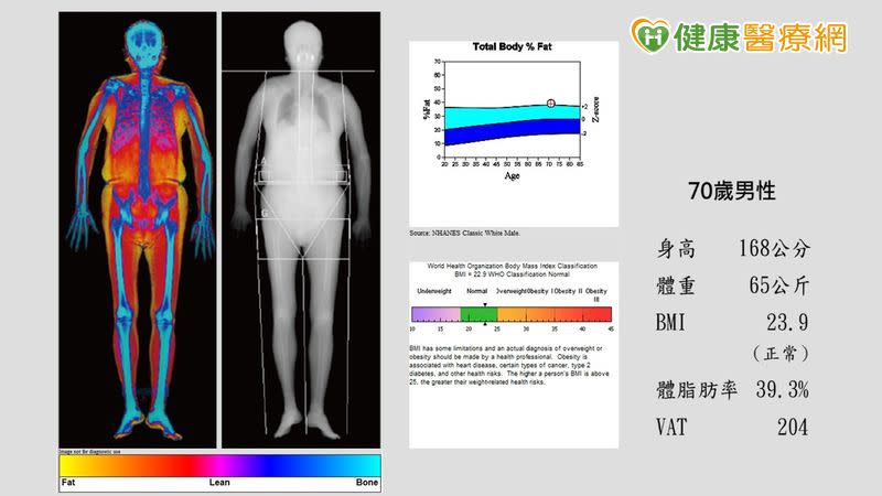 DXA身體組成檢查，提供體脂肪、肌肉含量和內臟脂肪報告，提供臨床醫師進行疾病風險評