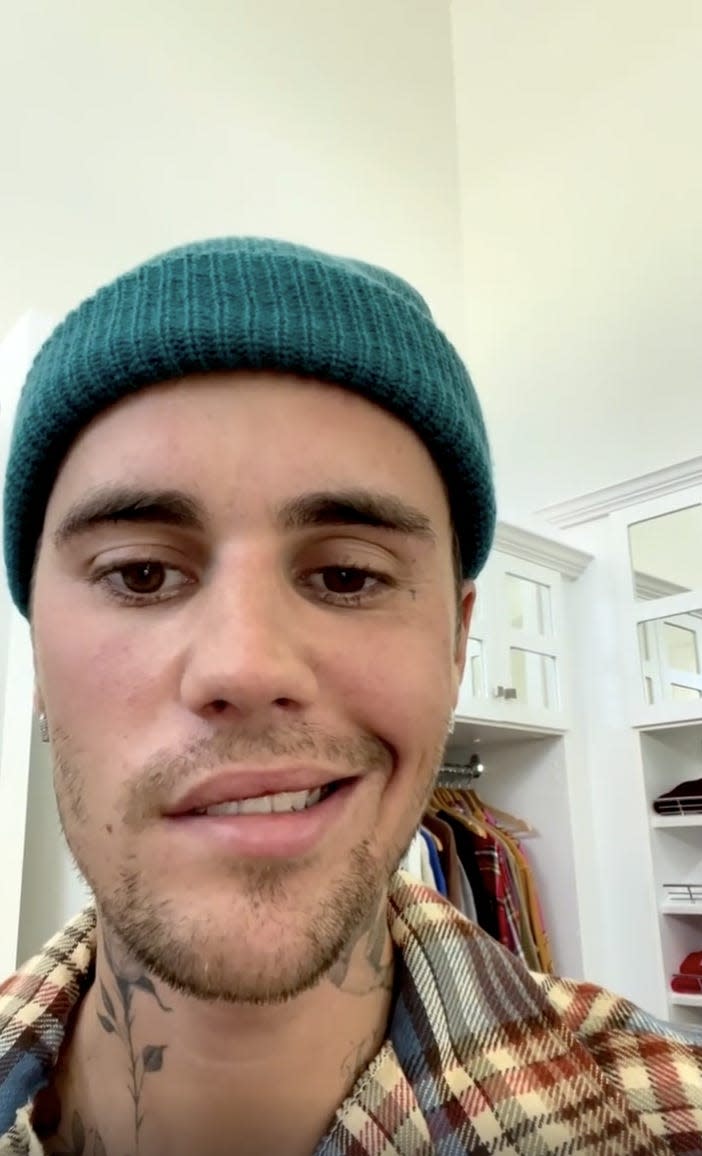 Justin Bieber face paralysis