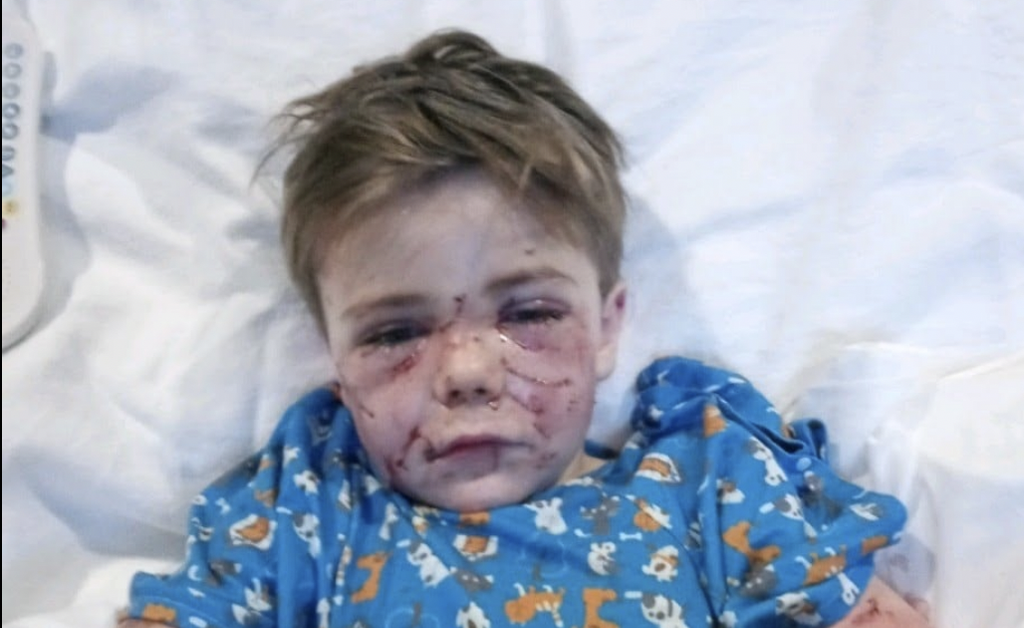 Conner Landers was attacked as he got off the bus. (Parker County Sheriff’s Office)