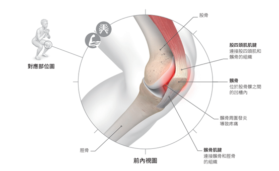 如何預防膝關節傷害