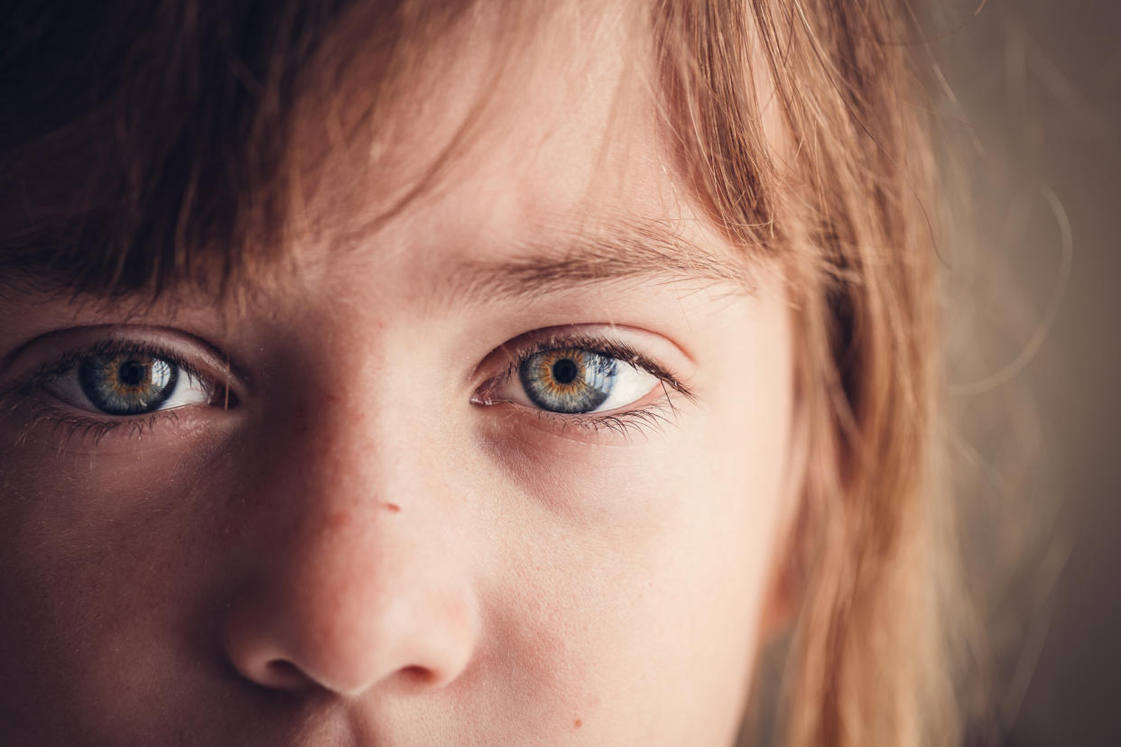 Nicht immer gelingt das perfekte Foto mit Blitzlicht, denn rote Augen stehen der idealen Aufnahme oft im Weg. Diese sind aber ein gutes Zeichen – deuten sie schließlich darauf hin, dass mit den Augen alles in Ordnung ist. (Foto: Getty Images)