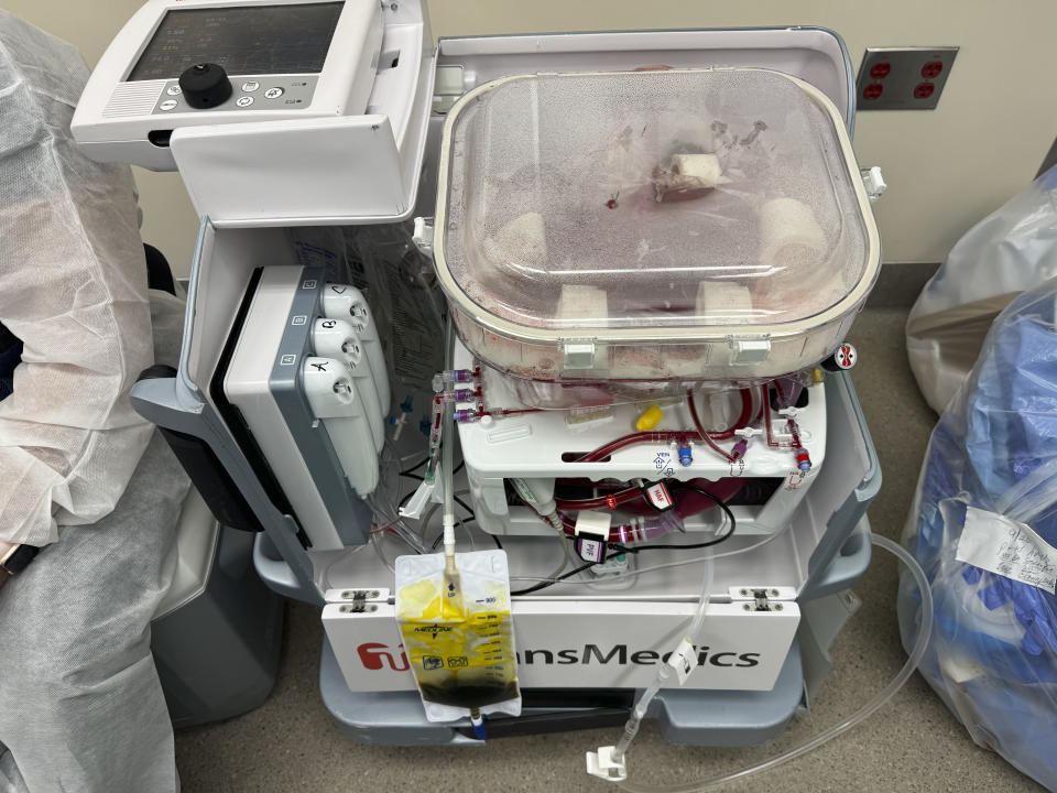 En una fotografía sin fecha de Daniel Borja-Cacho/Northwestern Medicine, una máquina de perfusión que contiene un hígado de un donante fallecido. (Daniel Borja-Cacho/Northwestern Medicine vía The New York Times)