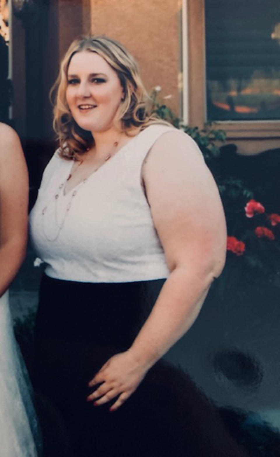 When Kayla Mehan first learned she needed to lose 150 pounds she was stunned. Then she started approaching it by losing 10 pounds at a time. (Courtesy Kayla Mehan)