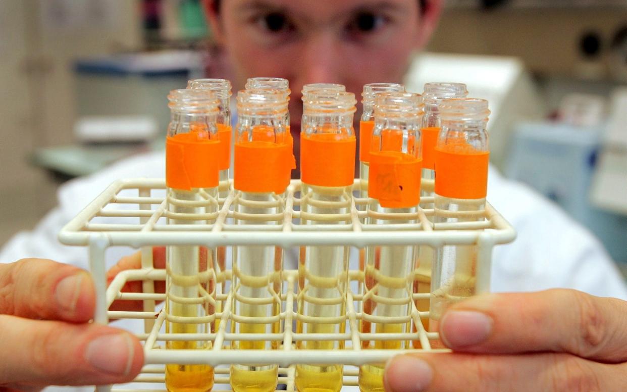 Urine samples are prepared for testing - AP