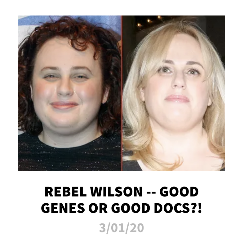 headline reading, "rebel wilson good genes or good docs?"