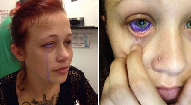 Catt Gallinger had the sclera tattoo done by an unqualified artist and could go blind. Photo: Facebook