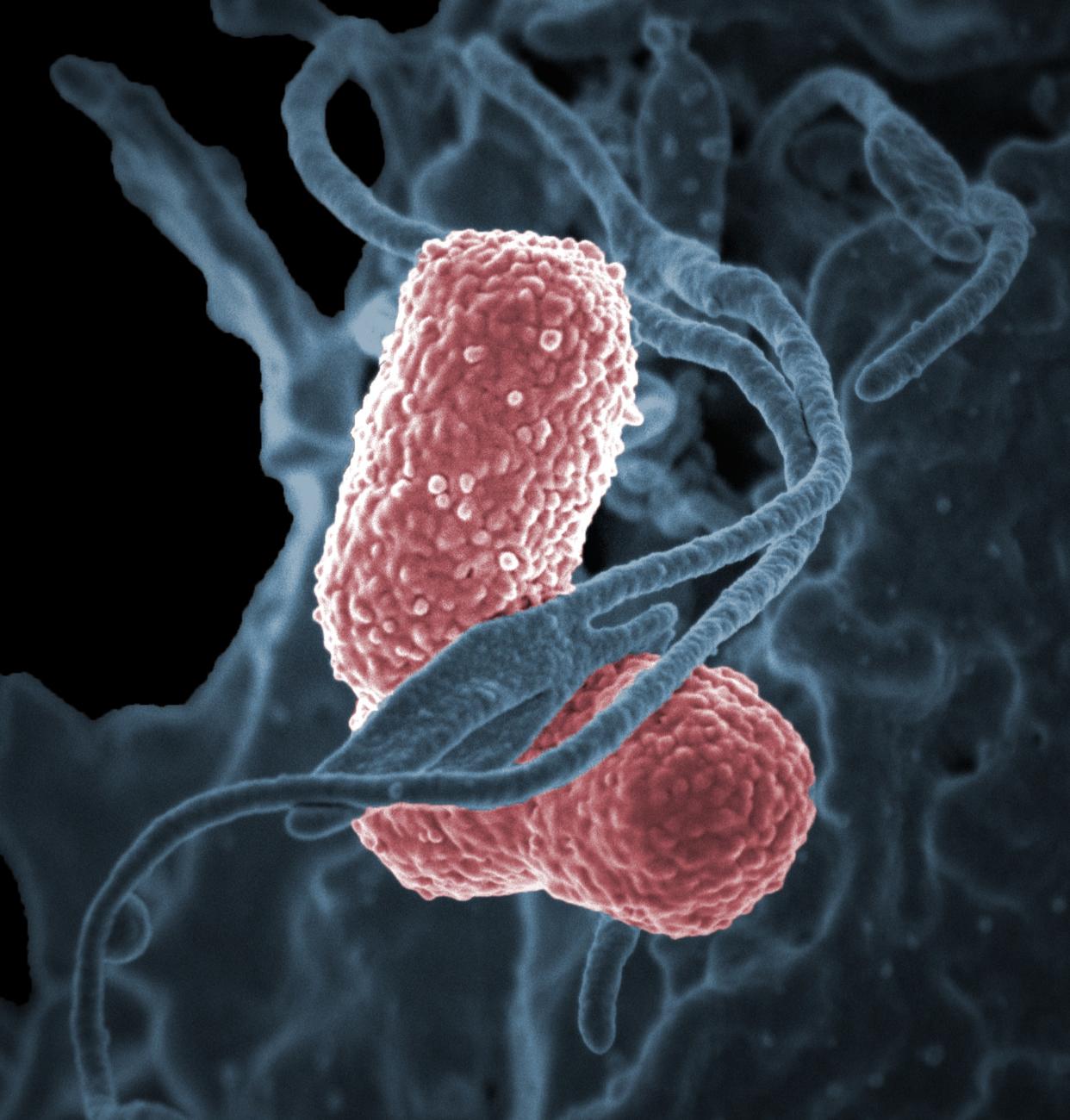 <span class="caption">Une cellule immunitaire (en gris) interagissant avec des bactéries Klebsiella pneumoniae (en rose), à l’origine d’infections nosocomiales (acquises à l’hôpital).</span> <span class="attribution"><a class="link " href="https://www.flickr.com/photos/nihgov/24463154650/in/album-72157656657569008/" rel="nofollow noopener" target="_blank" data-ylk="slk:National Institute of Allergy and Infectious Diseases, National Institutes of Health;elm:context_link;itc:0;sec:content-canvas">National Institute of Allergy and Infectious Diseases, National Institutes of Health</a>, <a class="link " href="http://creativecommons.org/licenses/by-sa/4.0/" rel="nofollow noopener" target="_blank" data-ylk="slk:CC BY-SA;elm:context_link;itc:0;sec:content-canvas">CC BY-SA</a></span>