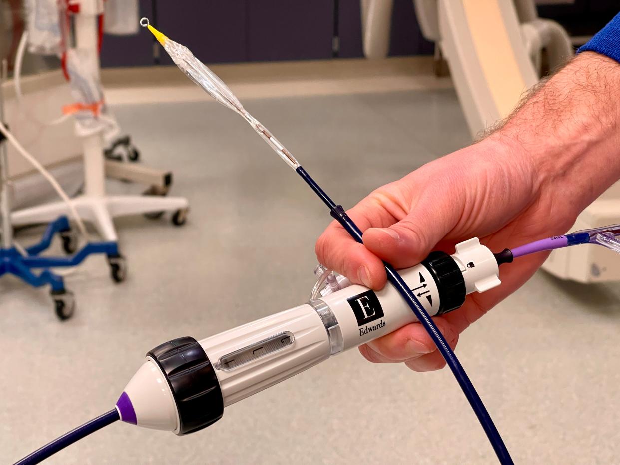 A delivery catheter like this one was used to carry a new aortic valve through blood vessels to the heart of Peter Courtney during a Jan. 8 procedure at Providence St. Vincent Medical Center in Portland.