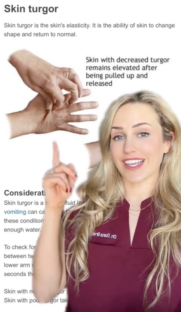 The popular TikTok doc explained that pinching your skin can reveal your hydration levels. TikTok / @footdocdana
