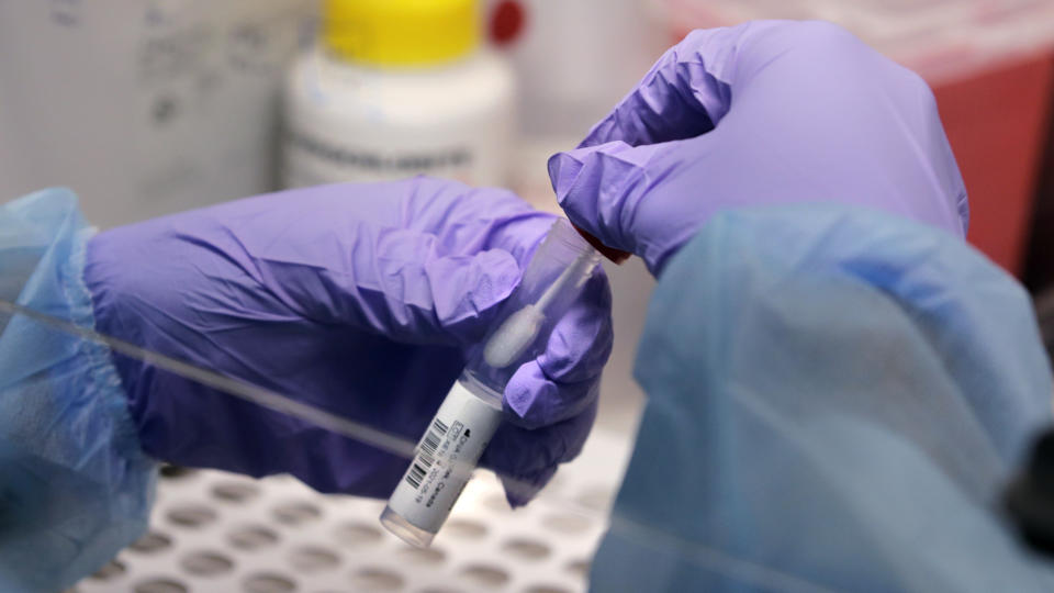 FILE - In this Thursday, July 23, 2020 file photo, a biomedical engineering graduate student handles a swab and specimen vial in a new COVID-19 on-campus testing lab in Boston. On Friday, July 31, 2020, The Associated Press reported on stories circulating online incorrectly asserting if your coronavirus test comes back positive, it may be because you have a common cold, according to the U.S. Centers for Disease Control and Prevention. Posts sharing this claim are mistaking CDC guidance on antibody tests for the health agency's guidance on tests for the virus. A common cold alone would not result in a positive COVID-19 test. (AP Photo/Charles Krupa)