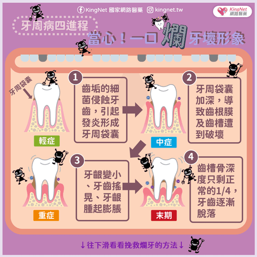 牙周病進程