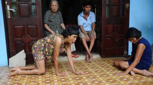 Nguyen Thi Binh (L-background), 76, sits next to her mentally and physically disabled children Nguyen Thanh Cong, 37, (R-background), Nguyen Thi Phiet, 54 (L-foreground) and Nguyen Thi Phuoc, 50, at her home near the central Danang city's airport on August 8, 2012. "Agent Orange" was sprayed over vast swathes of jungle by the US in an attempt to flush out Viet Cong guerrillas