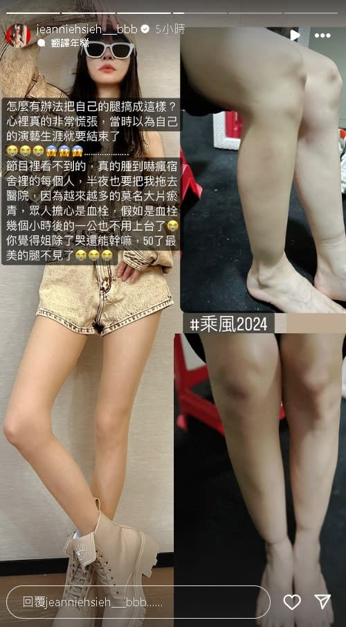 50歲謝金燕《浪姐5》出事！雙腳「腫脹瘀青」她哭喊：最美的腿不見了