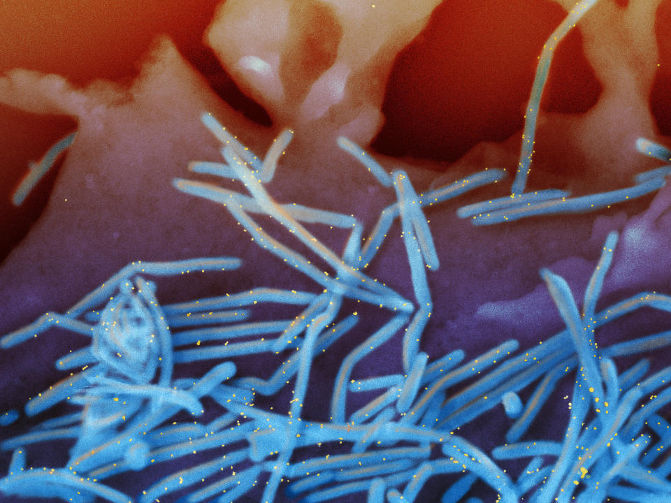 FILE - This electron microscope image provided by the National Institutes of Health shows human respiratory syncytial virus (RSV) virions, colorized blue, and anti-RSV F protein/gold antibodies, colorized yellow, shedding from the surface of human lung cells. The first vaccines to guard against RSV are rolling out in 2023 for older adults and pregnant women. (National Institute of Allergy and Infectious Diseases, NIH via AP, File)